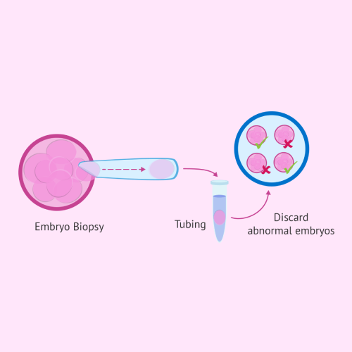 Pre-Implantation Genetics